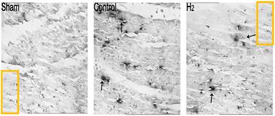 Retraction: Hydrogen-rich saline protects myocardium against ischemia/reperfusion injury in rats